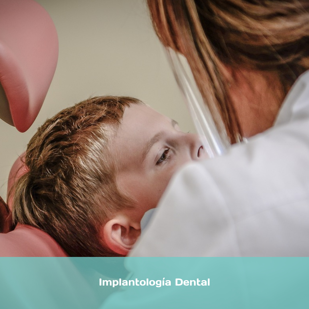 Implantología Dental